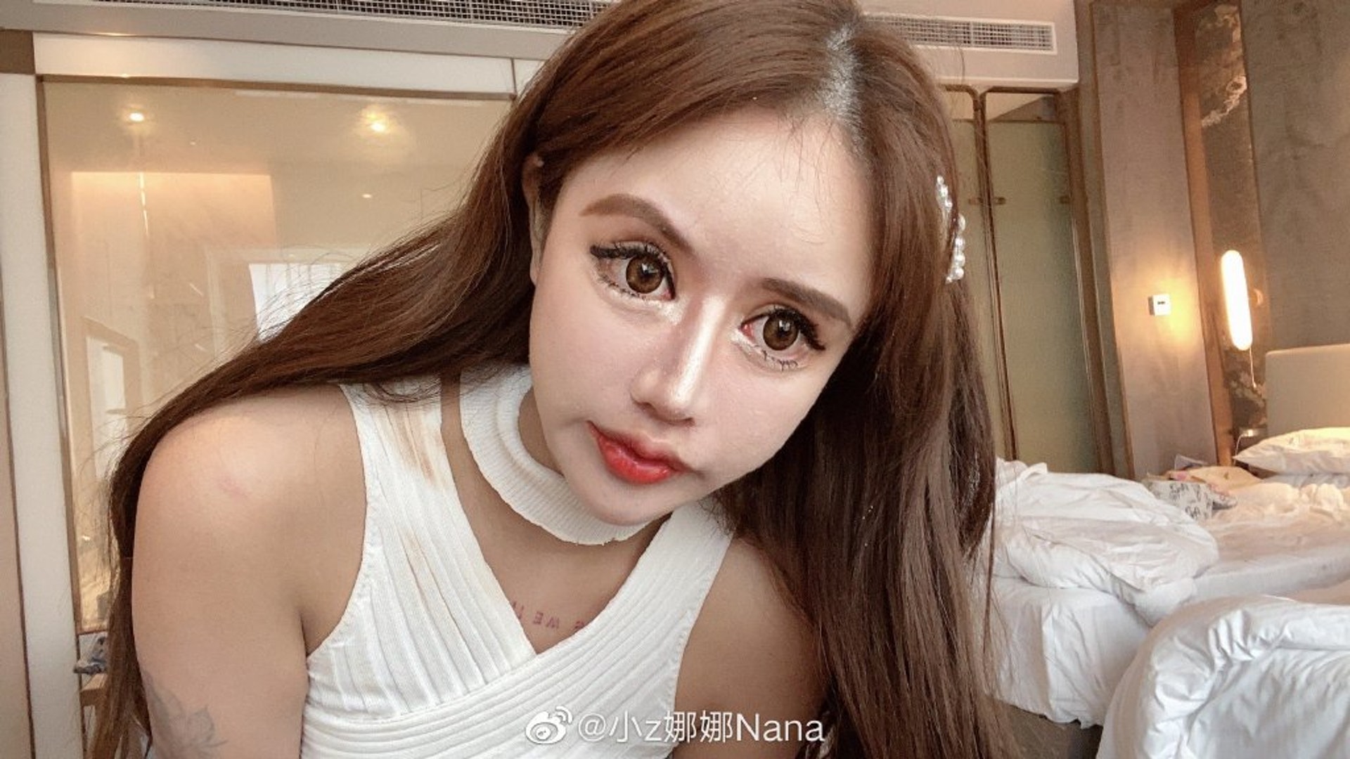 【画像あり】13歳から100回の美容整形を受けたナナさん、顔面が崩壊寸前 | sakamobi.com