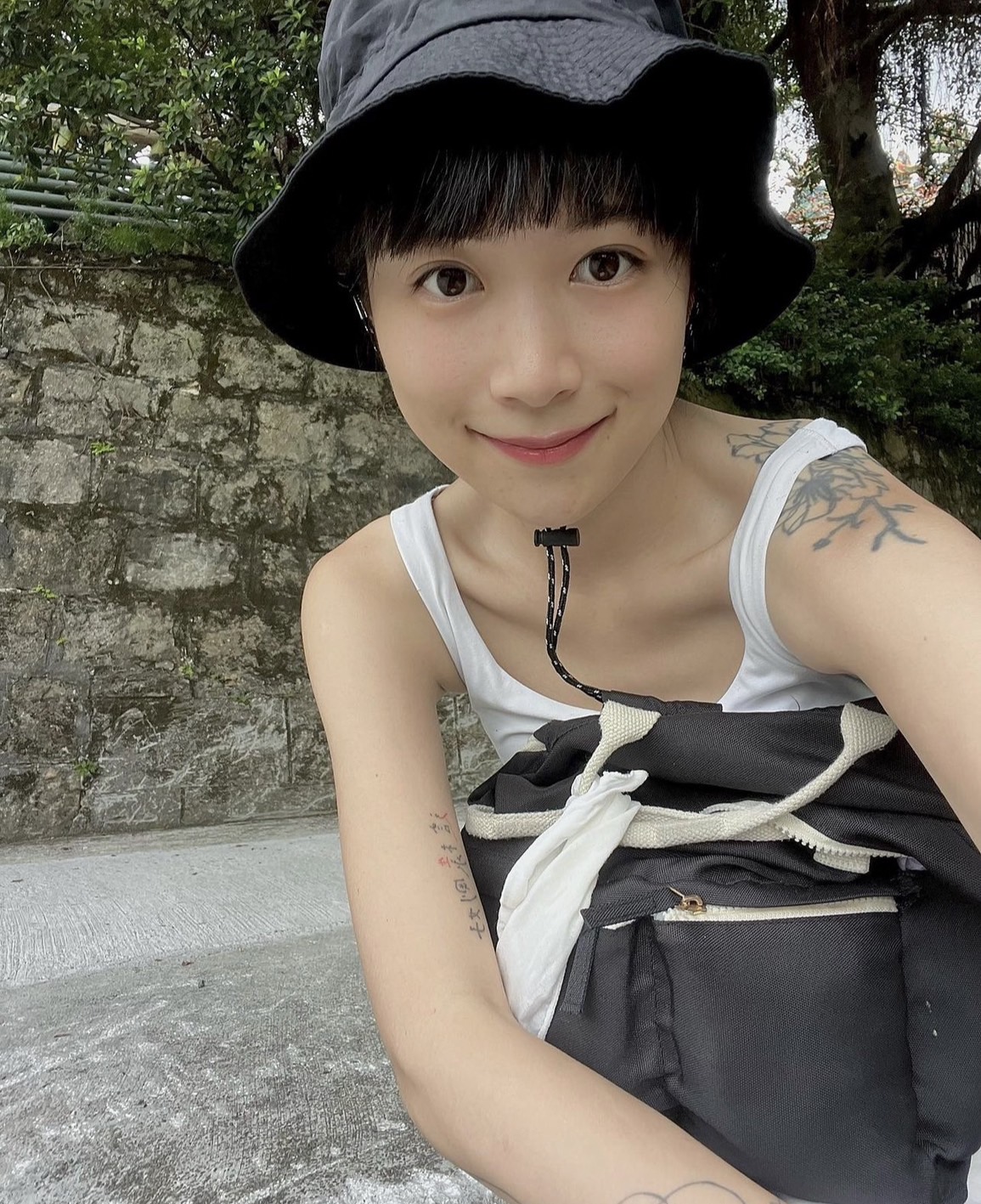 NanaQ 突自爆「整形失敗」真相曝光！前後對比圖超驚人